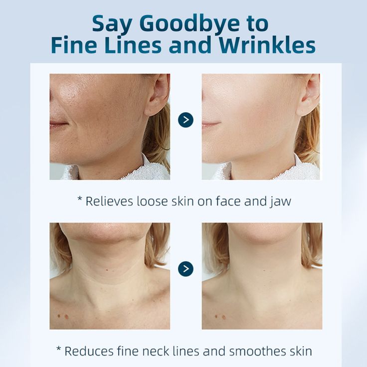 EMS Neck Beauty Device HY69 – Facial & Neck Lift Massager for Skin Tightening, Anti-Aging & Wrinkle Reduction
